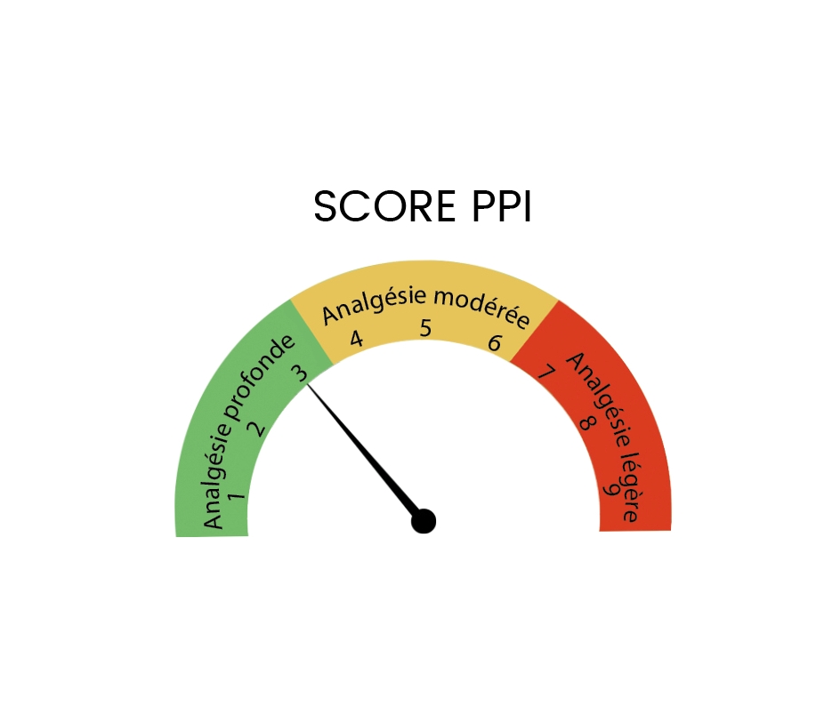 Score PPI